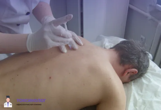 Процесс введения инъекционного препарата для кодирования Эспераль под лопатку пациента врачом в медицинских перчатках.